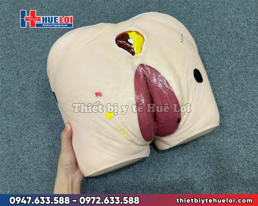 Mô hình thực hành chăm sóc vết thương cho điều dưỡng